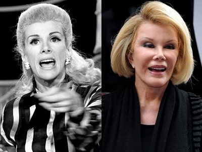 A picture of Joan Rivers before (left) and after (right) eye lift.